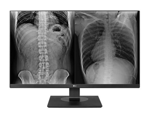 Monitor de revision clinica